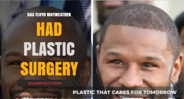 Floyd Mayweather Plastic Surgery Rumors: Fact or Fiction?