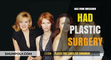 Has Fran Drescher Had Plastic Surgery? Unveiling the Truth