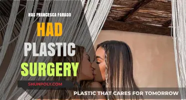 Francesca Farago's Transformation: Plastic Surgery Rumors Explored