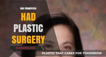 Has Francesca Had Plastic Surgery? Uncovering the Truth Behind Her Look