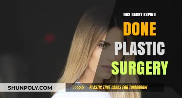 Has Gabby Espino Undergone Plastic Surgery? The Truth Revealed