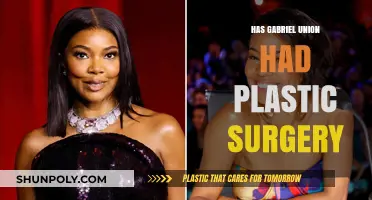 Has Gabrielle Union Undergone Plastic Surgery? Examining the Rumors and Facts