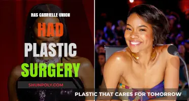 Gabrielle Union's Transformation: Plastic Surgery Speculations and Truths Revealed
