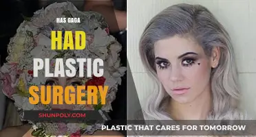 Has Lady Gaga Undergone Plastic Surgery? Unveiling the Truth
