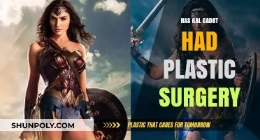 Gal Gadot's Transformation: Plastic Surgery Rumors and Realities