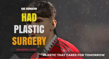 Has Garnacho Had Plastic Surgery? Unveiling the Truth Behind the Rumors