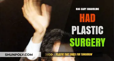 Gary Shandling's Appearance: Plastic Surgery Rumors Explored and Debated