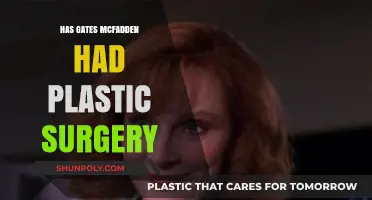 Gates McFadden Plastic Surgery: Fact-Checking the Star Trek Actress' Transformation