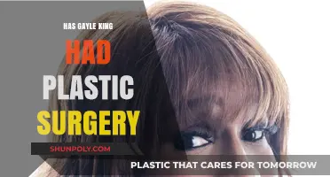 Gayle King's Transformation: Plastic Surgery Speculations and Truths Revealed
