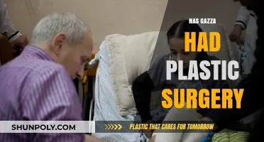 Gazza's Transformation: Unveiling the Truth About His Plastic Surgery Rumors
