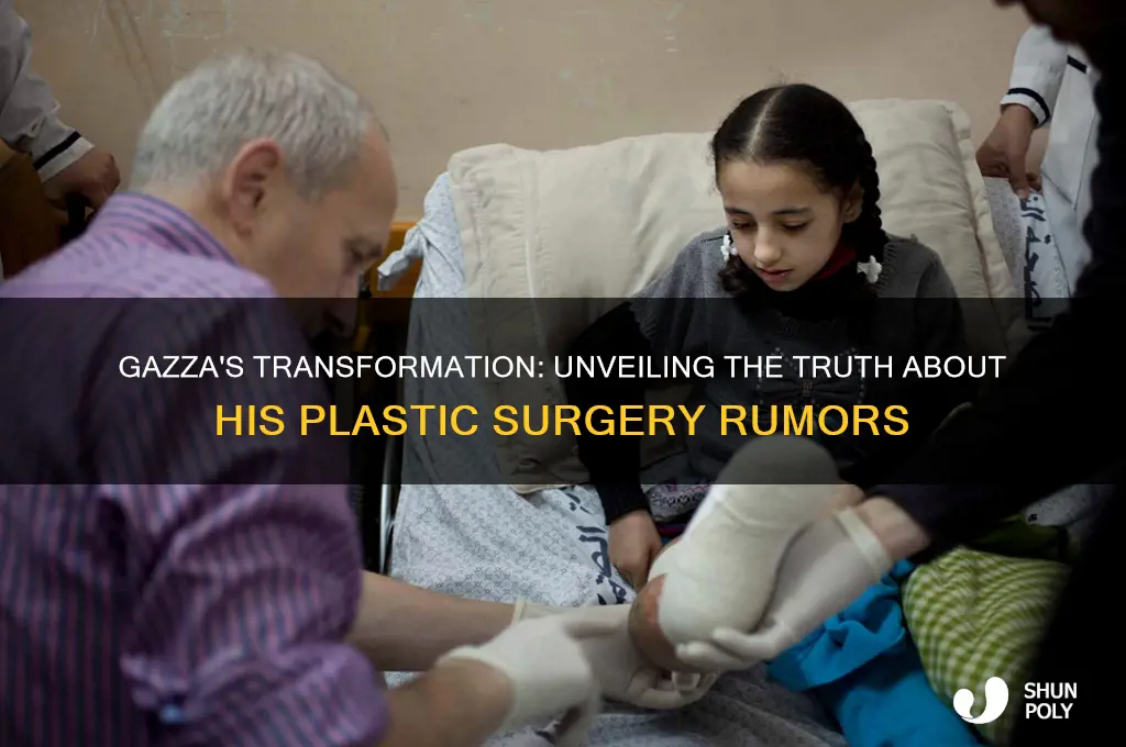 has gazza had plastic surgery