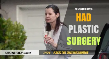 Geena Davis Plastic Surgery: Fact-Checking the Actress' Transformation Rumors