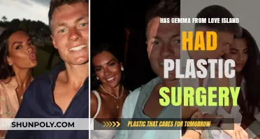 Gemma Owen's Transformation: Plastic Surgery Rumors and Reality