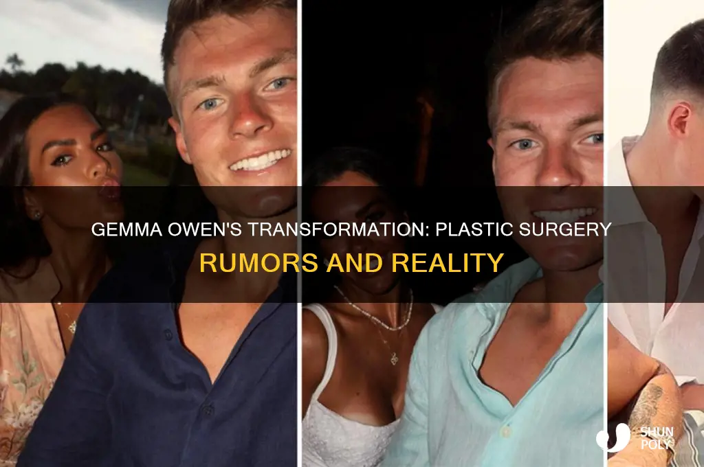 has gemma from love island had plastic surgery