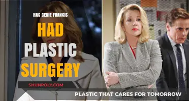 Genie Francis Plastic Surgery: Fact-Checking the Rumors and Speculations