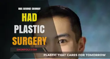 George Conway's Appearance: Plastic Surgery Speculations and Rumors Explored