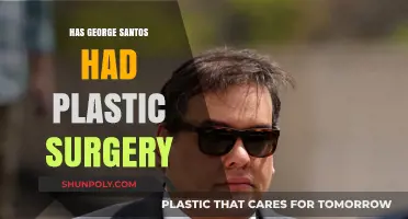 Has George Santos Had Plastic Surgery? Uncovering the Truth