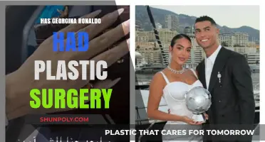 Georgina Ronaldo's Transformation: Plastic Surgery Rumors Explored and Debunked