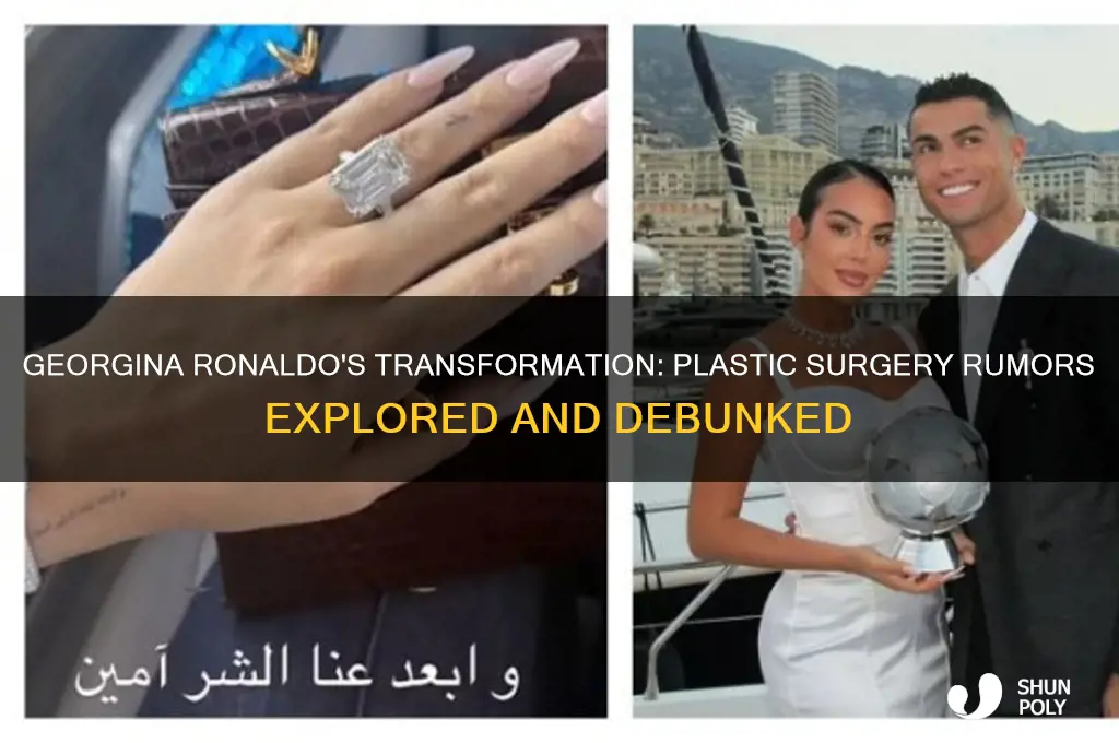 has georgina ronaldo had plastic surgery