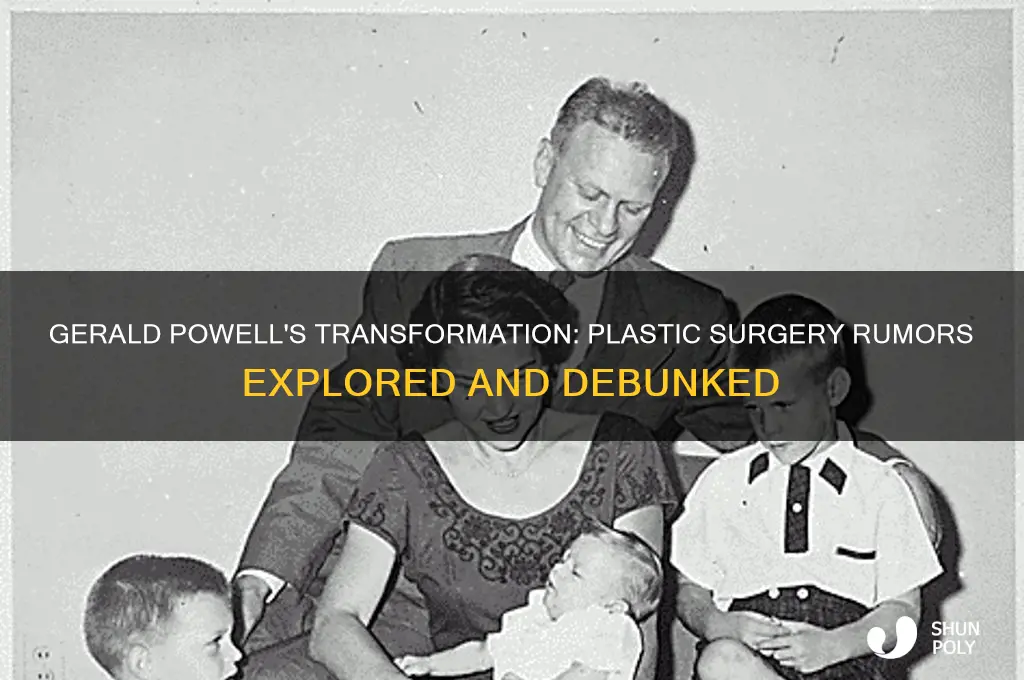 has gerald powell had plastic surgery