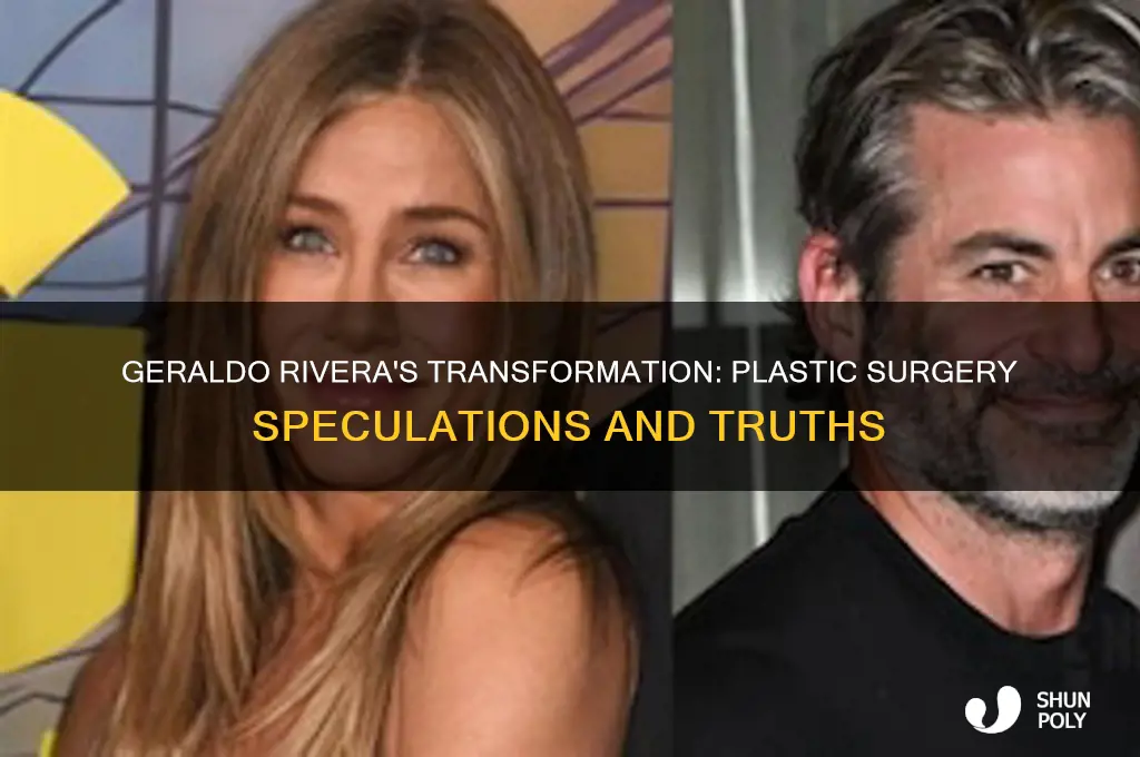 has geraldo rivera had plastic surgery