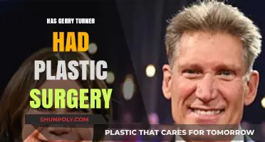 Gerry Turner's Transformation: Plastic Surgery Speculations and Truths Revealed