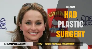 Giada De Laurentiis Plastic Surgery: Fact-Checking the Rumors and Speculation
