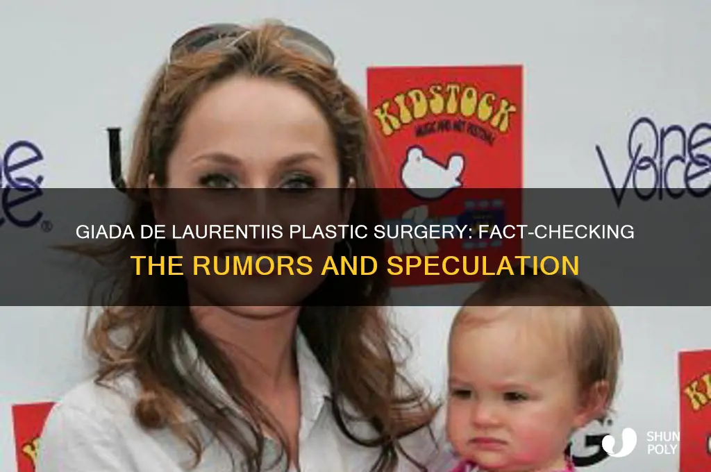 has giada had plastic surgery
