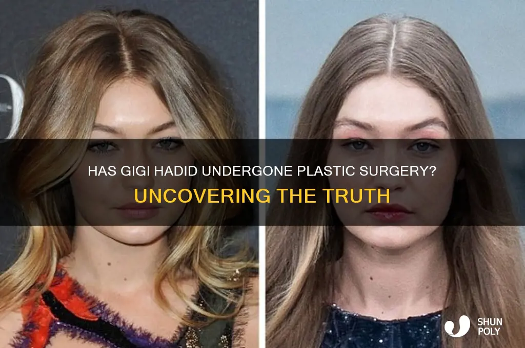 has gigi had plastic surgery