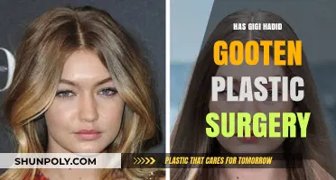 Gigi Hadid Plastic Surgery Speculations: Fact or Fiction?