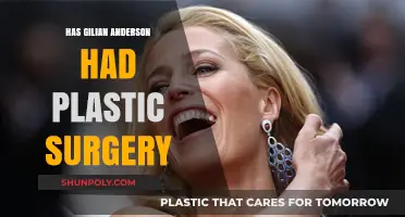 Gillian Anderson's Transformation: Plastic Surgery Rumors Explored