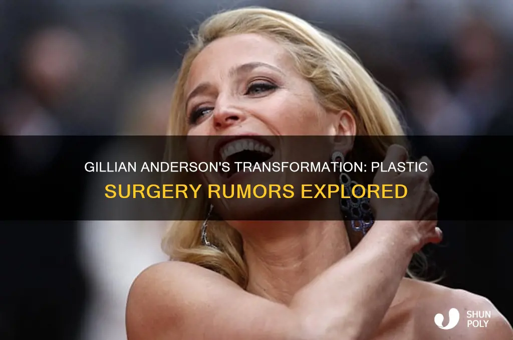 has gilian anderson had plastic surgery