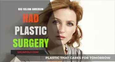 Gillian Anderson's Transformation: Plastic Surgery Speculations and Truths