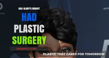 Gladys Knight's Transformation: Plastic Surgery Rumors Explored and Debunked