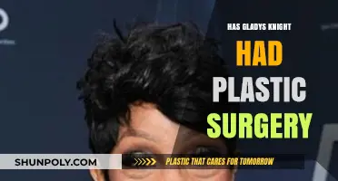 Gladys Knight's Transformation: Plastic Surgery Rumors and Reality Revealed