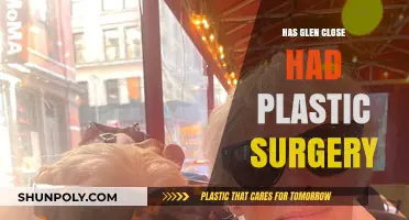 Glen Close Plastic Surgery: Fact-Checking the Actress's Appearance Transformation