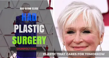 Glenn Close's Ageless Look: Plastic Surgery Speculations Explored