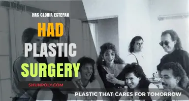 Gloria Estefan's Transformation: Plastic Surgery Speculations and Truths Revealed