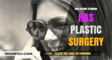 Gloria Steinem's Appearance: Plastic Surgery Speculations and Aging Gracefully