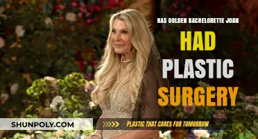 Joan's Golden Bachelorette Transformation: Plastic Surgery Speculations Explored