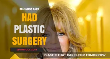 Golden Hawn's Transformation: Plastic Surgery Speculations and Truths Revealed