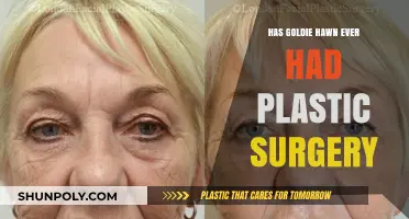 Goldie Hawn's Ageless Beauty: Plastic Surgery Speculations Explored