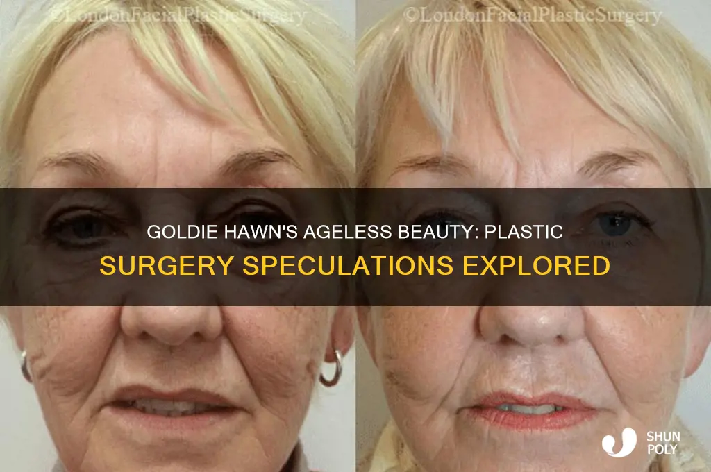has goldie hawn ever had plastic surgery