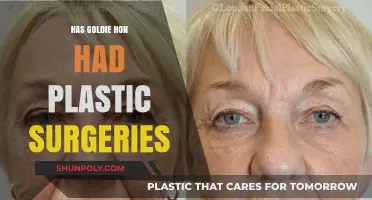 Goldie Hon's Transformation: Unveiling the Truth About Plastic Surgery Rumors