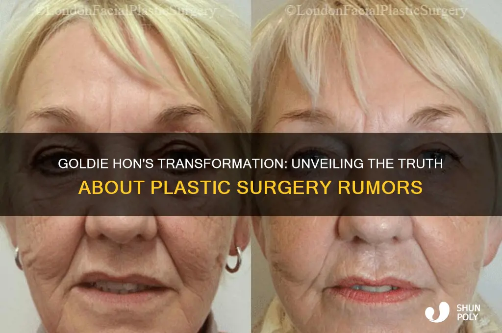 has goldie hon had plastic surgeries