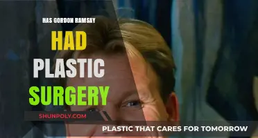Gordon Ramsay's Transformation: Plastic Surgery Rumors Explored