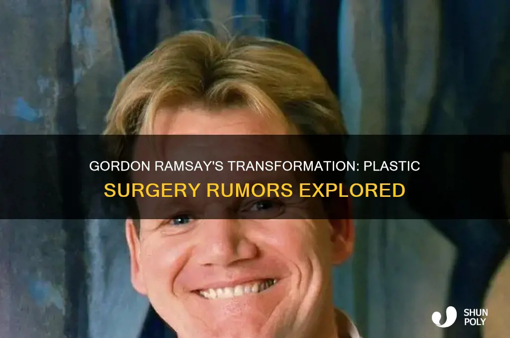 has gordon ramsay had plastic surgery