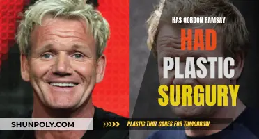 Gordon Ramsay's Plastic Surgery: Fact or Fiction?