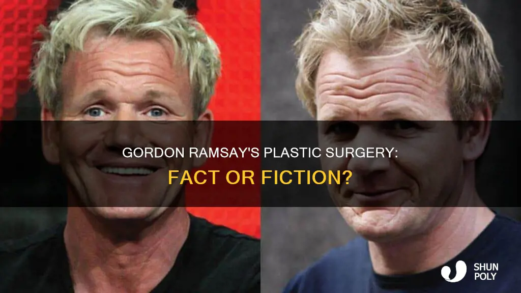 has gordon ramsay had plastic surgury