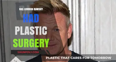 Gordon Ramsay's Transformation: Plastic Surgery Rumors Explored